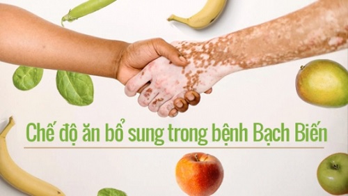 xây dựng chế độ ăn khoa học cho người bạch biến