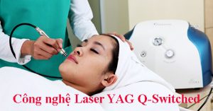 Công nghệ Laser YAG Q-Switched