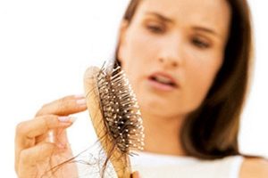 Bệnh rụng tóc từng mảng sẽ làm bạn mất tự tin