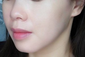 cách trị dị ứng da mặt đơn giản hiệu quả